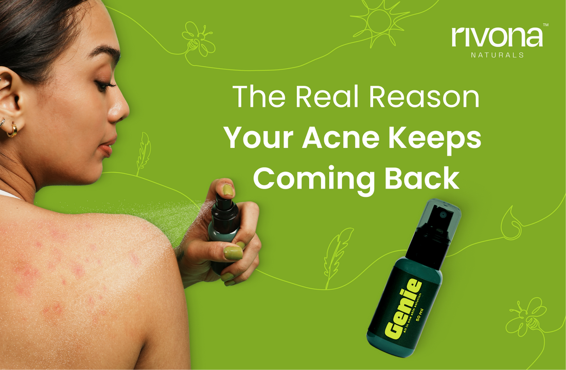 The Real Reason Your Acne Keeps Coming Back