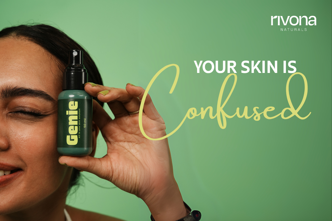 Your skin is confused – skincare tips to understand skin concerns and maintain healthy, balanced skin with Rivona Naturals
