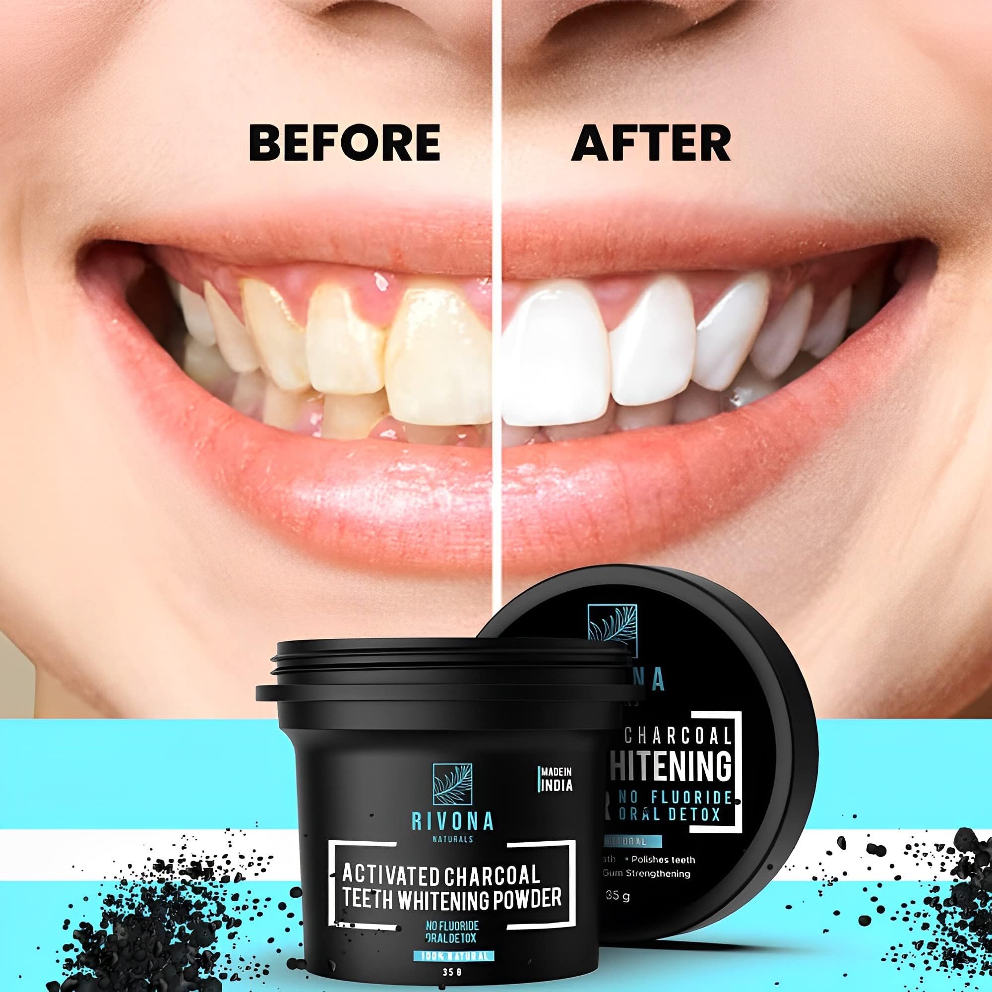 Rivona Naturals Activated Charcoal Teeth Whitening Powder  (Pack 2)