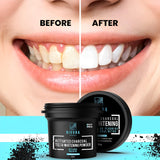 Rivona Naturals Activated Charcoal Teeth Whitening Powder  (Pack 2)
