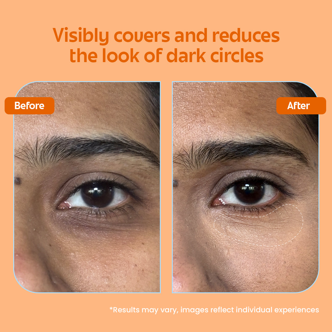 Brightening eye cream and concealer for dark circle reduction